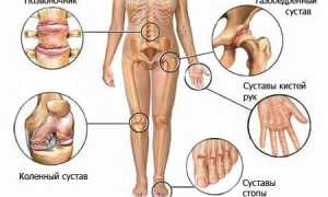 Здоровье суставов. Опасность артроза и артрита