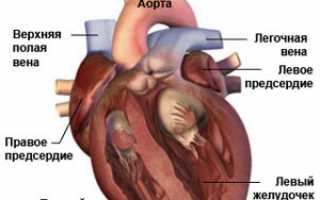 Аритмия