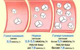 Гипогликемия
