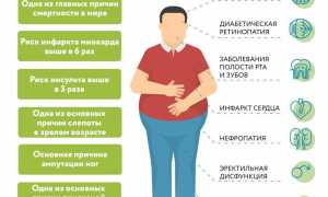 Сахарный диабет