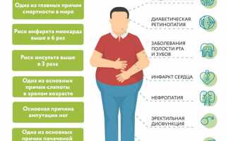 Сахарный диабет