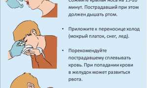 Кровотечение из носа