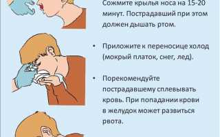 Кровотечение из носа