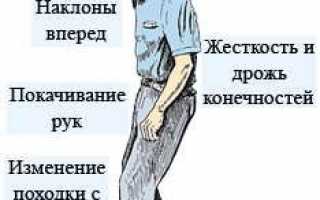 Болезнь Паркинсона