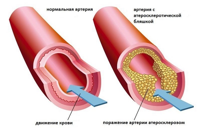 Настойка клевера польза, сбор и приготовление настойки для применения в народной медицине