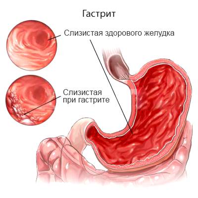 Польза и состав различных сортов пива для мужчин