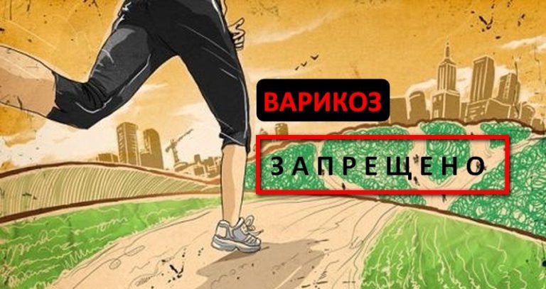 Бег при варикозе - показания и противопоказания тренировок