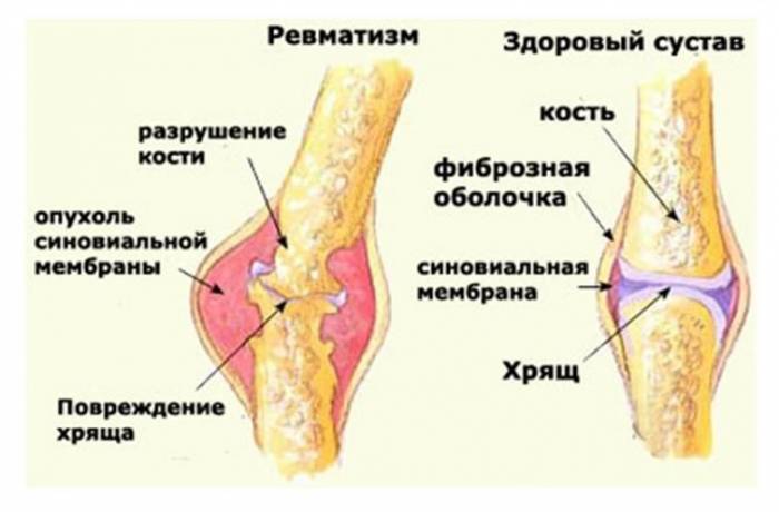 Кровохлебка