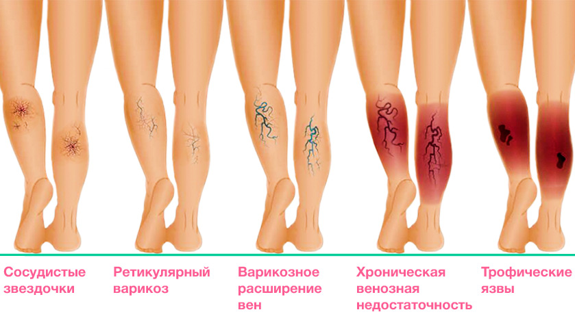 Кровохлебка