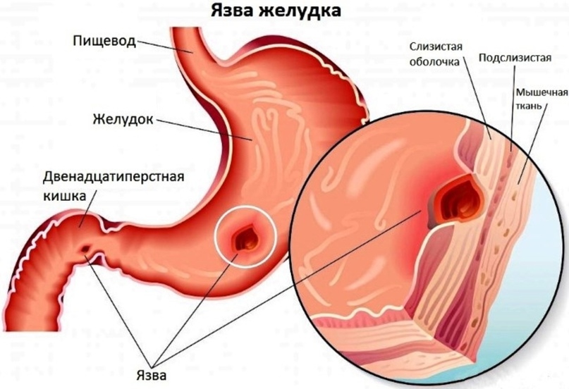 Девясил - применение в лечебных целях в народной медицине