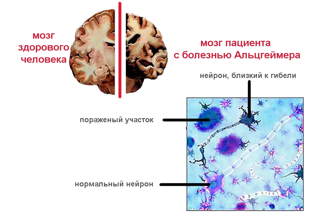 Молоко с куркумой - польза напитка для женщин, мужчин, детей