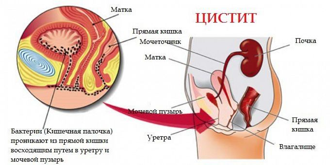 Золототысячник - описание, сбор и заготовка целебного отвара растения