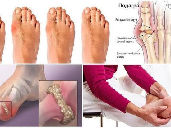 Сок лопуха - лечебные свойства и применения растения