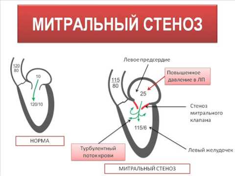 Спринтерский бег и виды дистанций, правильная техника выполнения
