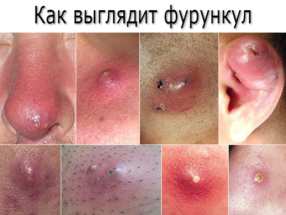 Вероника лекарственная - полезные свойства, рецепты применения для лечения