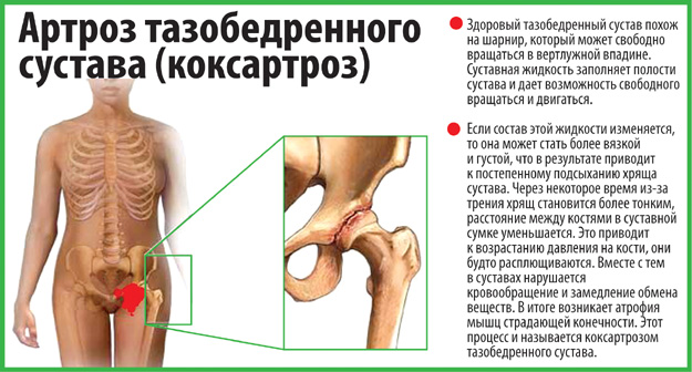 20 упражнений Бубновского - принципы гимнастики для здоровья