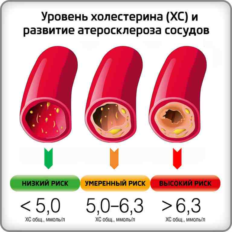 Гипохолестериновая диета - какие продукты, что запрещено, подробное меню