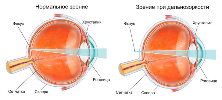 Упражнения для улучшения зрения по методикам знаменитых ученых