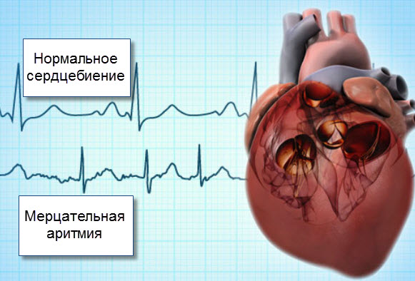 Упражнения Стрельниковой на видео с описанием техники дыхания и выполнения упражнений