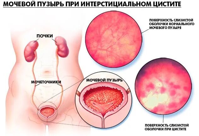 Корень петрушки - лечебные свойства, польза для помощи в оздоровлении
