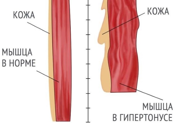 Правила проведения зарядки для новорожденных