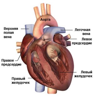 Аритмия