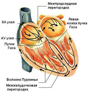 Аритмия