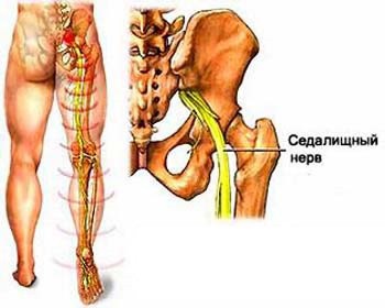 Седалищный нерв