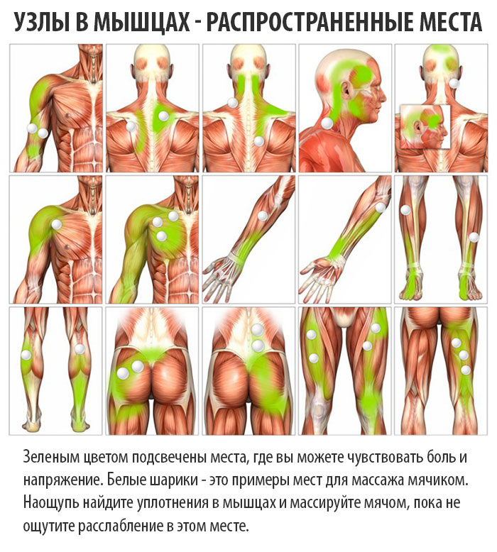 Узлы в мышцах - как избавиться?