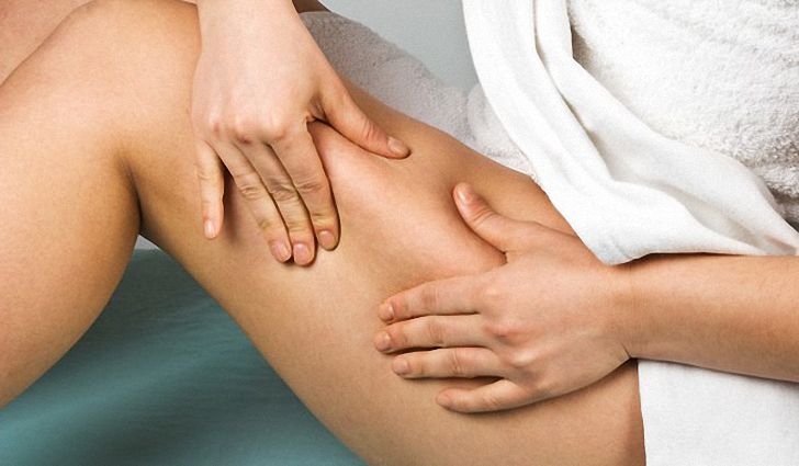 Виды ожирения Виды ожирения