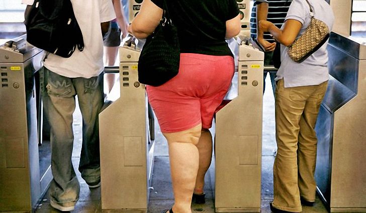 Степени ожирения Степени ожирения