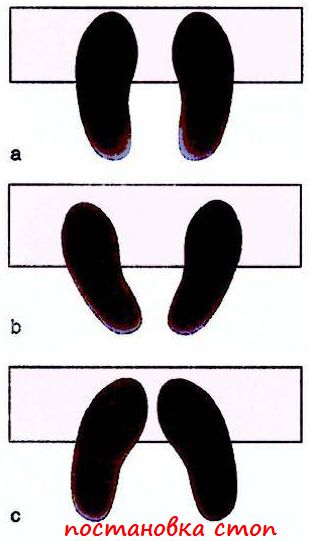 Упражнение осел, постановка стоп Упражнение осел, постановка стоп