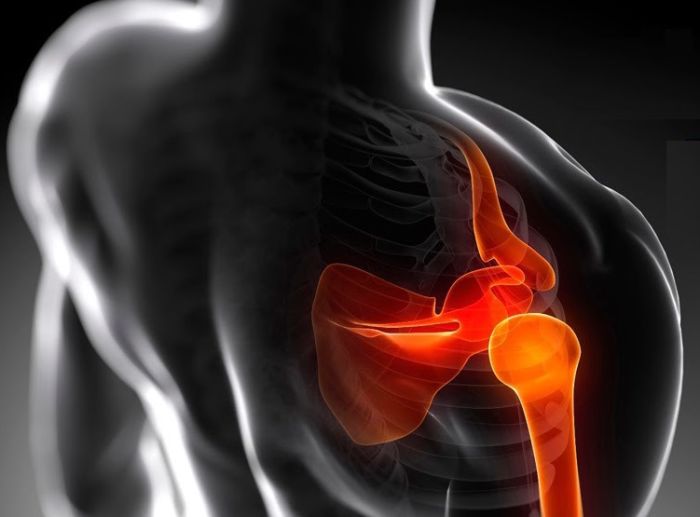 Как обезопасить тебя от травм при тренировке по самообороне Как обезопасить тебя от травм при тренировке по самообороне