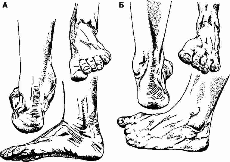 Разминка Голеностоп Разминка Голеностоп